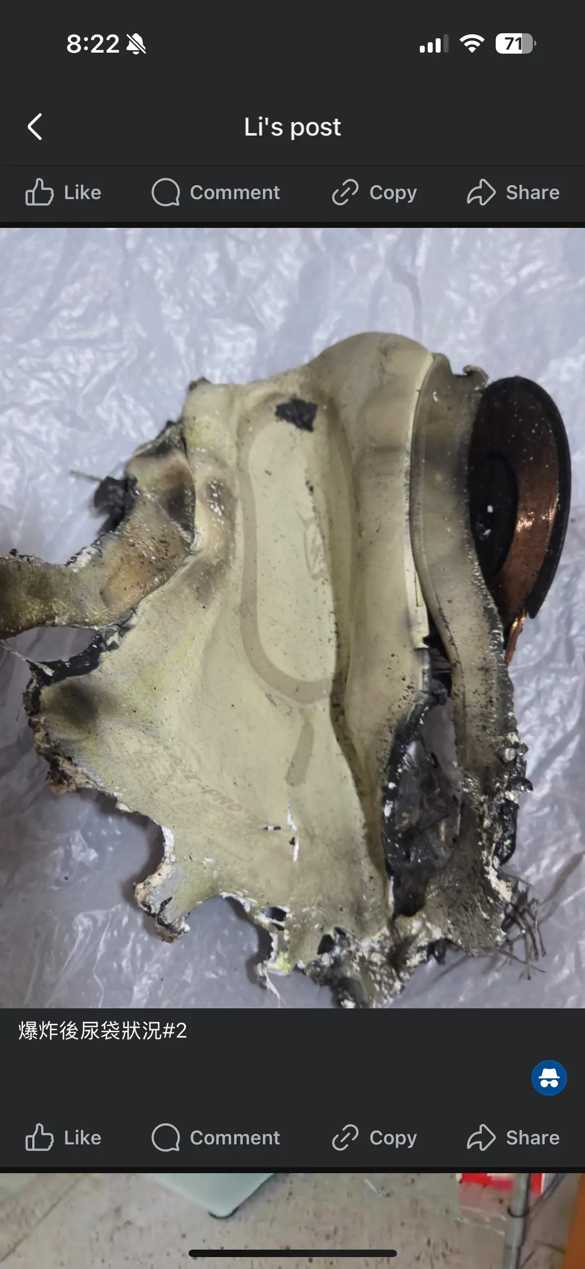 香港品牌尿袋疑爆炸起火 用家手指燒傷發黑 附公司3點回應