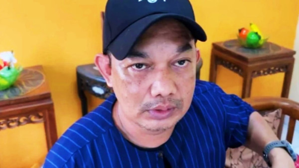 大馬男一次吃7個榴槤 隔天竟中風倒地！營養師拆解2類食物忌配榴槤