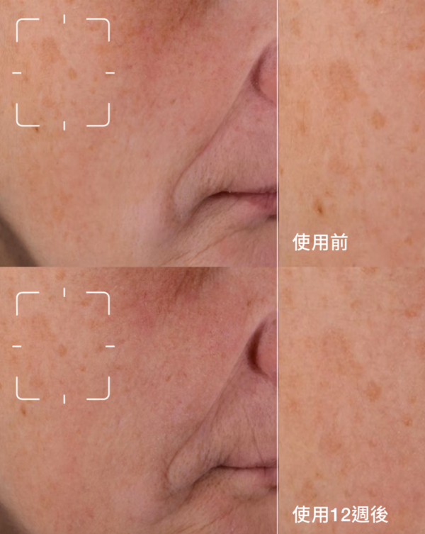 美白精華推薦｜CLINIQUE 全效亮白淡斑精華