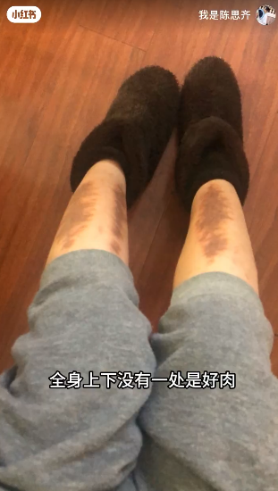 前TVB女藝人陳思齊自爆慘遭呃錢積蓄清空 坎坷經歷曝光身體出事曾暴瘦至80磅
