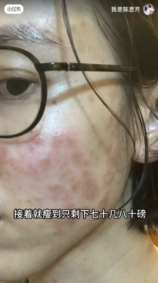 前TVB女藝人陳思齊自爆慘遭呃錢積蓄清空 坎坷經歷曝光身體出事曾暴瘦至80磅