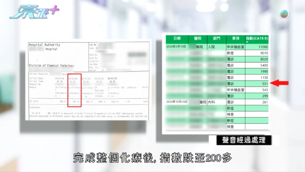 60歲癌母手術中離奇心臟停頓 家屬質疑醫療失誤 竟收到匿名信爆驚人內幕