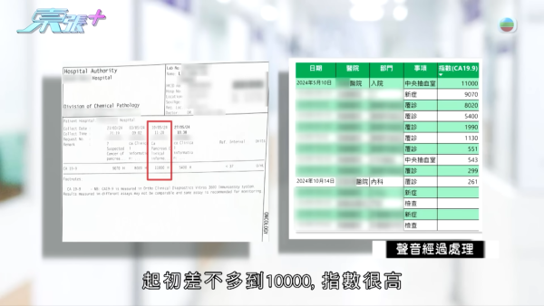60歲癌母手術中離奇心臟停頓 家屬質疑醫療失誤 竟收到匿名信爆驚人內幕