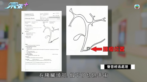 60歲癌母手術中離奇心臟停頓 家屬質疑醫療失誤 竟收到匿名信爆驚人內幕