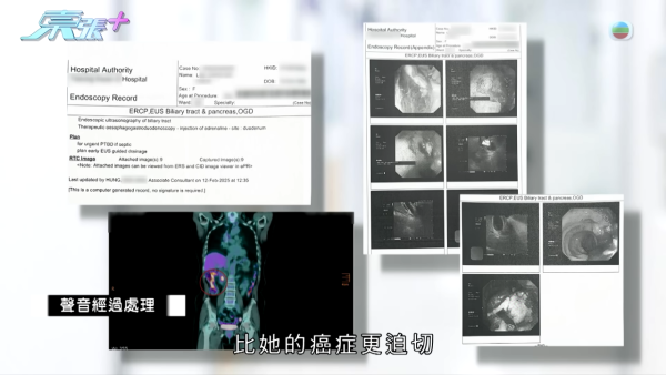 60歲癌母手術中離奇心臟停頓 家屬質疑醫療失誤 竟收到匿名信爆驚人內幕