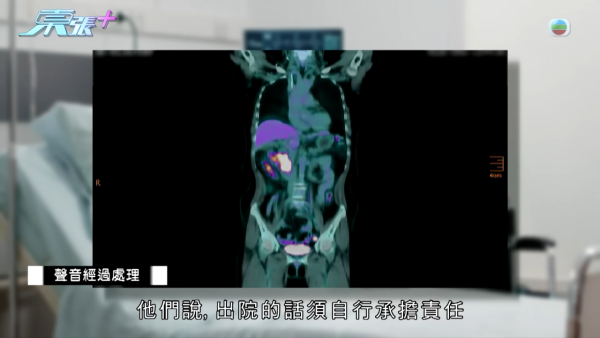 60歲癌母手術中離奇心臟停頓 家屬質疑醫療失誤 竟收到匿名信爆驚人內幕