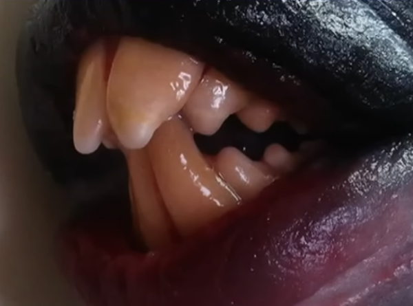 泰國海灘「致命隱形殺手」！專家警告遭此生物螫到嚴重恐喪命！即學保命3招救人自救 