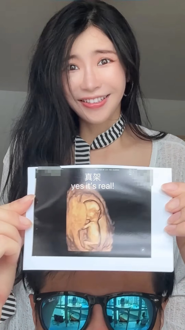 離巢TVB女藝人挺8月巨肚影孕婦寫真 準媽媽上圍再度升級獲激讚：身材100分