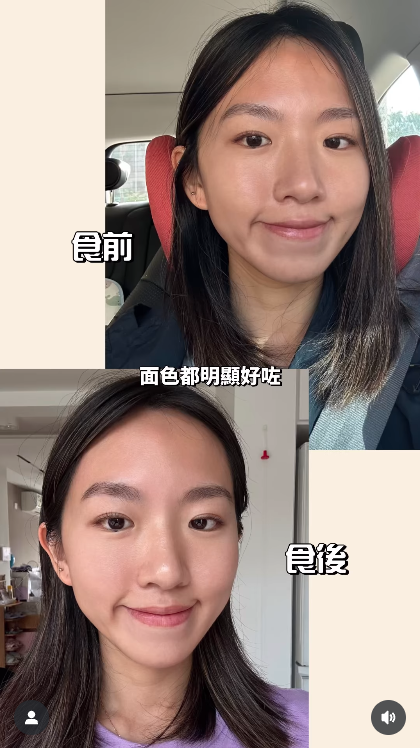 有一種攰叫「24/7打喊露」！瞓極唔飽可能已跌入「慢性疲勞」困局　1招重啟身體「活力引擎」