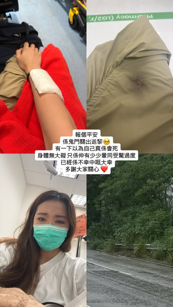 東張女神天雨路滑驚傳嚴重車禍急送醫院 受驚過度自爆鬼門關瞬間：以為自己真係會死