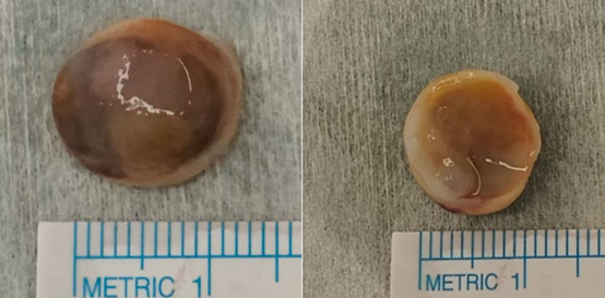 男子食絲瓜1原因中毒險死 毒性勁過砒霜！慎食6種常見蔬果／高溫煮熟都有毒