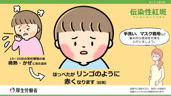 遊日注意！日本沖繩那霸市爆「蘋果病」病毒傳播力強暫無藥物可醫！孕婦感染恐流產 