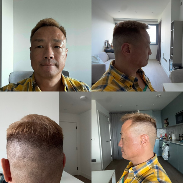 王喜FB撰千字文留低「遺言」陷被迫害死局 絕望聲明「記得諗起我係點樣死」