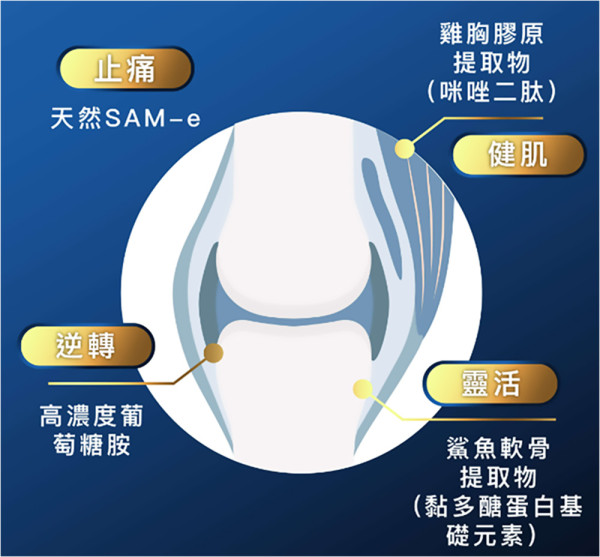 你的手腕痛屬於哪一種？ 手腕痛全面攻略：找出4大元兇、徹底擺脫疼痛困擾