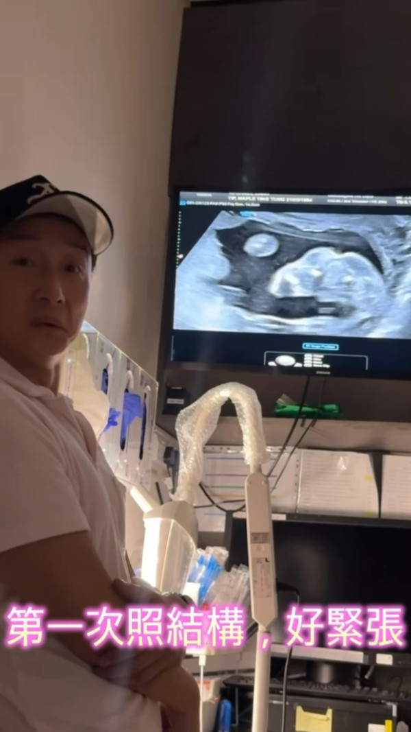 方力申陪愛妻做產檢BB超聲波照曝光 參觀豪華產房因一件事反問醫護：無爸爸㗎？