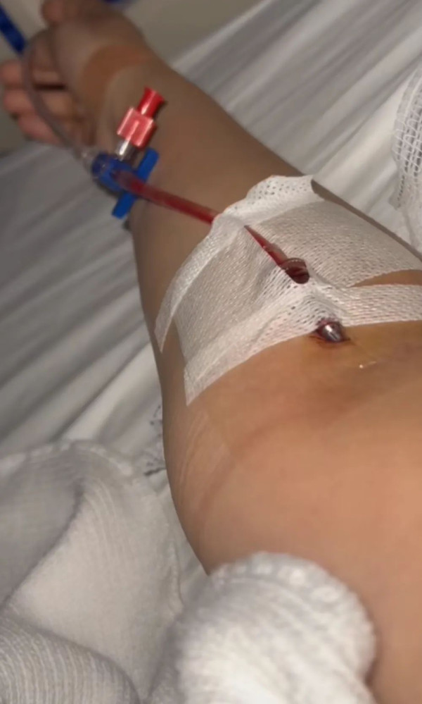 峇里島青年旅社驚傳食物中毒 多名內地客中招 1女不幸喪命 