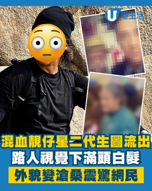 混血靚仔星二代超近距離生圖流出 滿頭白髮滄桑外貌震驚網民
