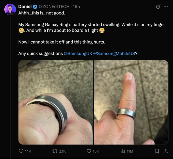 百萬YouTuber恐怖經歷 智能戒指膨脹卡住手指無法脫下 遭拒絕登機需緊急送院