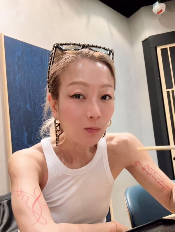 鄭秀文驚傳意外受傷入醫院休養十幾日 身體撕裂兩處需坐輪椅代步狀況曝光