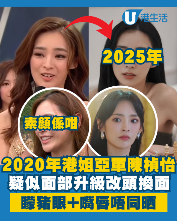 2020年港姐亞軍陳楨怡疑似面部升級 改頭換面「矇豬眼」放大一倍！嘴唇更厚唔同晒