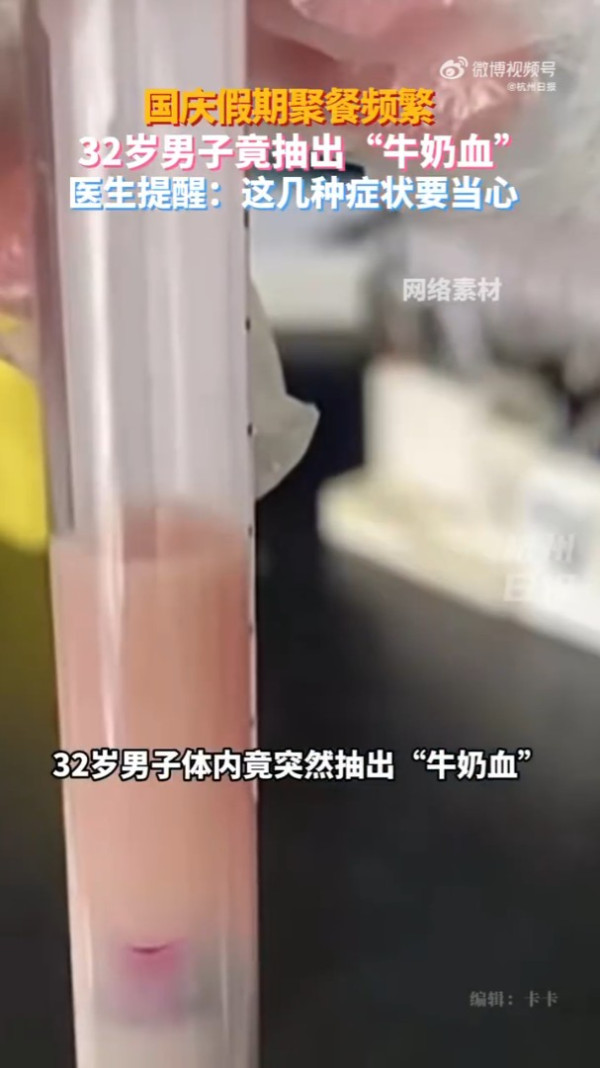 內地32歲男國慶打完邊爐食燒烤 突然腹痛不止 送院抽出「牛奶血」險死 