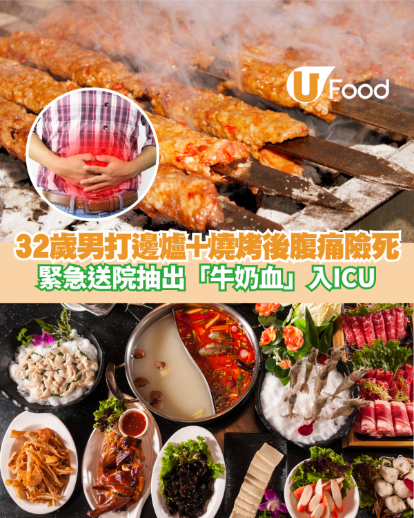 32歲男打邊爐+燒烤後腹痛險死！緊急送院抽出「牛奶血」入ICU搶救