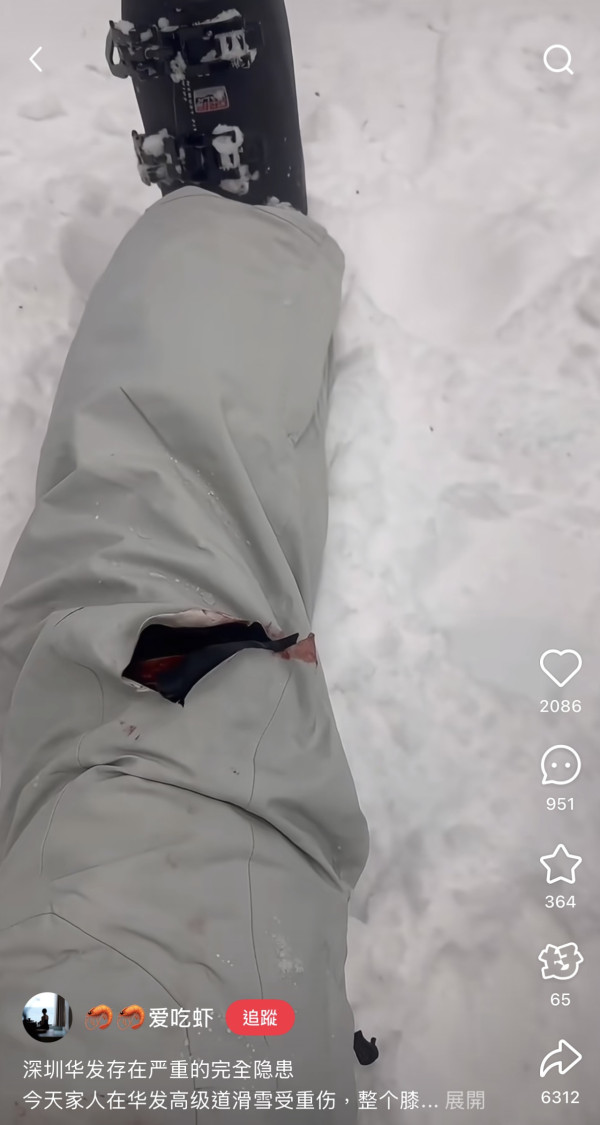 事主滑雪受傷(圖片：愛吃蝦@小紅書）