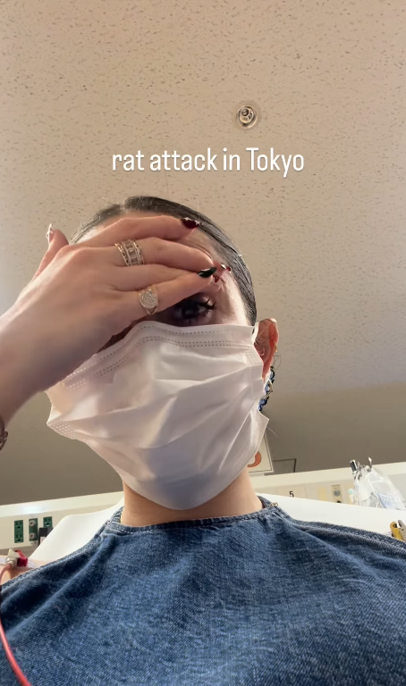 遊日注意!東京新宿街頭驚見老鼠橫行!遊客被老鼠咬傷腳流血足部發黑