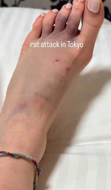 遊日注意!東京新宿街頭驚見老鼠橫行!遊客被老鼠咬傷腳流血足部發黑