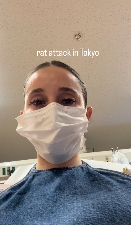 遊日注意!東京新宿街頭驚見老鼠橫行!遊客被老鼠咬傷腳流血足部發黑