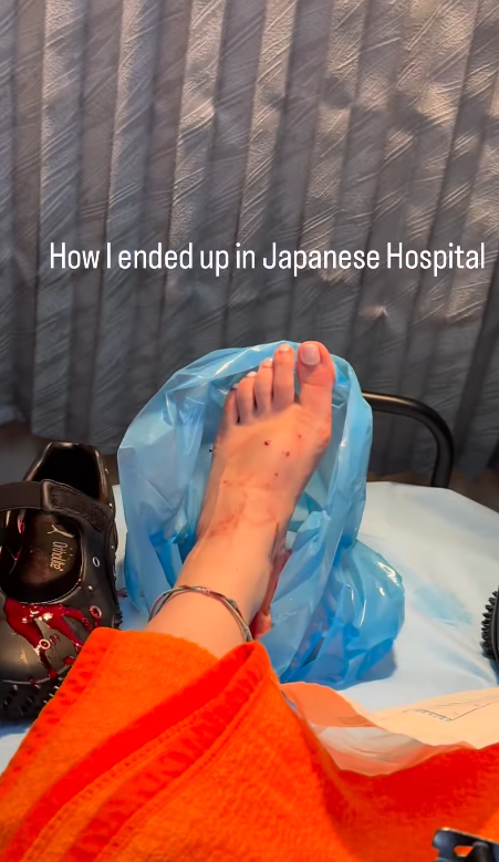 遊日注意!東京新宿街頭驚見老鼠橫行!遊客被老鼠咬傷腳流血足部發黑