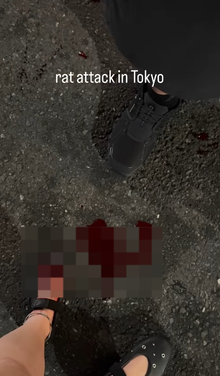 遊日注意!東京新宿街頭驚見老鼠橫行!遊客被老鼠咬傷腳流血足部發黑