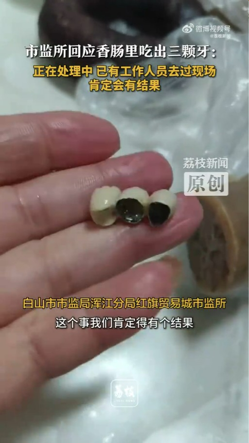 內地接連爆出香腸燒賣「食出相連牙齒」！ 餐廳僅願意賠呢個數惹事主不滿 