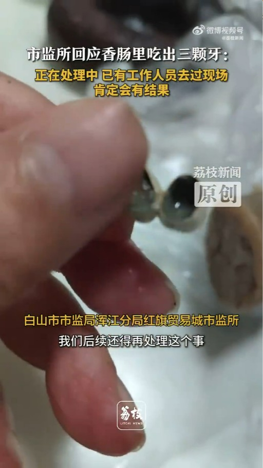 內地接連爆出香腸燒賣「食出相連牙齒」！ 餐廳僅願意賠呢個數惹事主不滿 