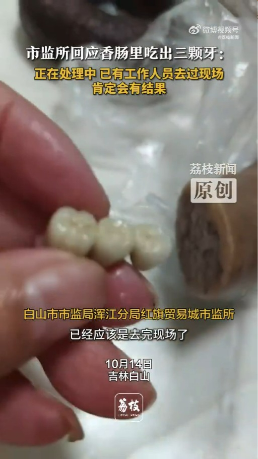 內地接連爆出香腸燒賣「食出相連牙齒」！ 餐廳僅願意賠呢個數惹事主不滿 