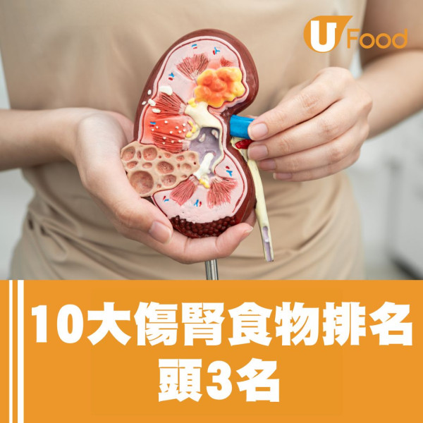 【傷腎食物排名榜出爐】醫生揭10大傷腎食物 燒臘飯高踞第4/拉麵只排第2！