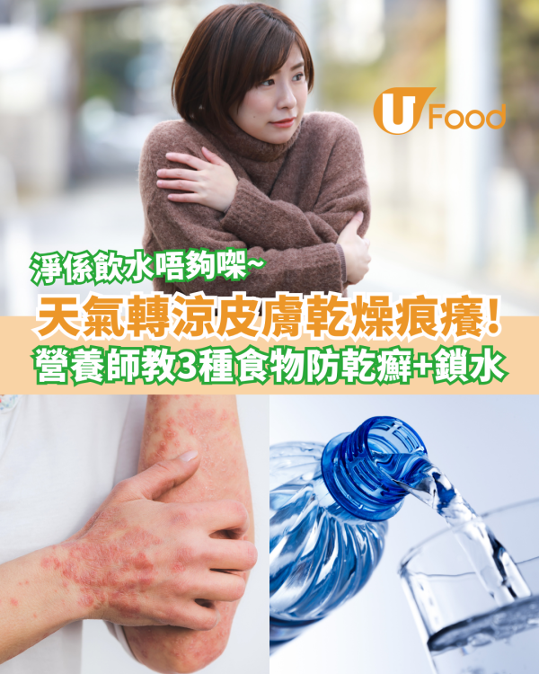 【乾燥皮膚】天氣轉涼皮膚容易有乾燥痕癢！台灣營養師教你吃3種食物預防乾癬