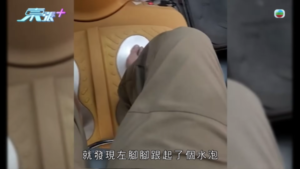 八兩金前妻誤信無牌中醫！腳部嚴重潰爛險截肢？受訪哭訴反被網民鬧爆：無知好可怕