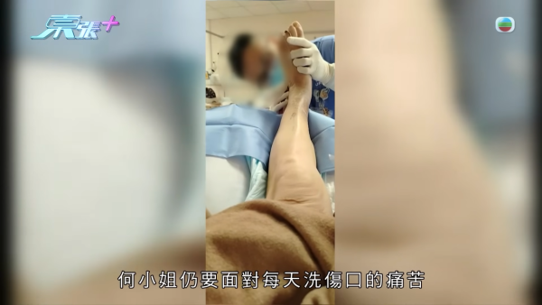 八兩金前妻誤信無牌中醫！腳部嚴重潰爛險截肢？受訪哭訴反被網民鬧爆：無知好可怕