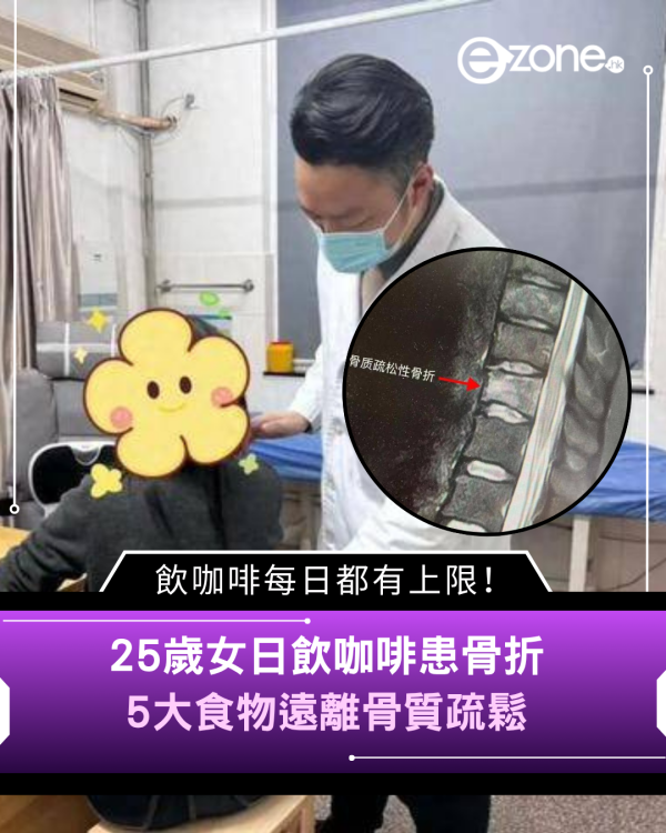 25歲女日飲咖啡患骨折 飲咖啡每日都有上限！ 5大食物遠離骨質疏鬆