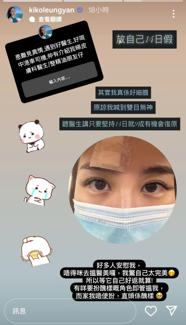 前《愛回家》女藝人遭電髮棒擲面恐毀容 受傷留疤後首度露面揭最新情況