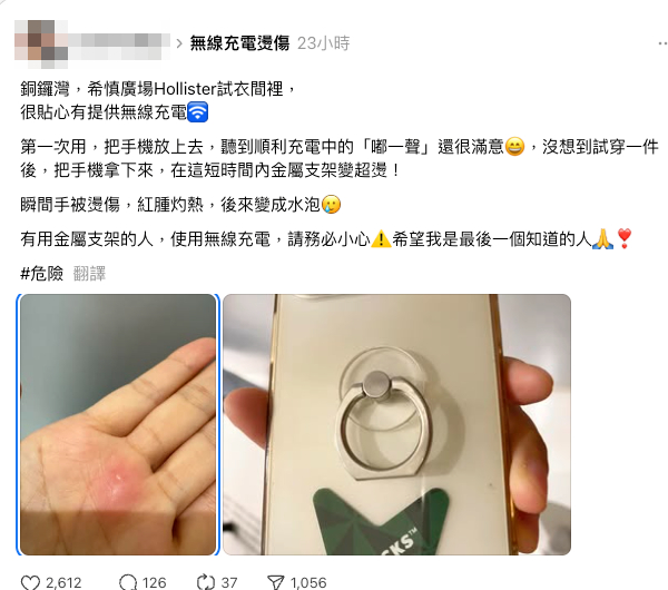 女子借用無線充電器被燙傷 手掌紅腫起水泡 疑機身一物熱到變「電磁爐」