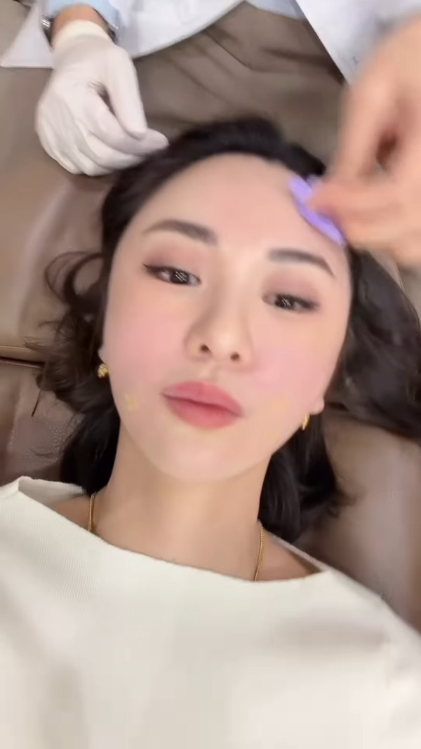 裕美拍片公開人生第一次韓國整容過程 親揭手術後三日面腫驚嚇真面目