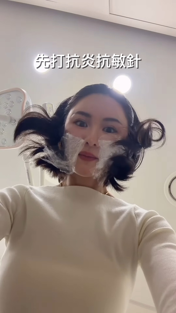 裕美拍片公開人生第一次韓國整容過程 親揭手術後三日面腫驚嚇真面目