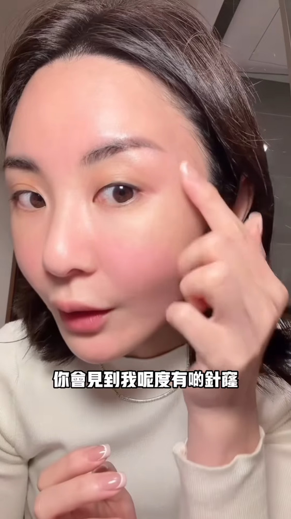 裕美拍片公開人生第一次韓國整容過程 親揭手術後三日面腫驚嚇真面目