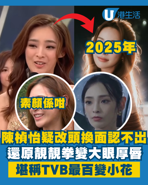 2020年港姐亞軍陳楨怡疑似面部升級 改頭換面「矇豬眼」放大一倍!嘴唇更厚唔同晒