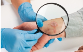 中大醫院減價|千項醫療服務調整收費:疫苗/內視鏡/眼科手術!承認「比最貴更貴」院方終讓步?