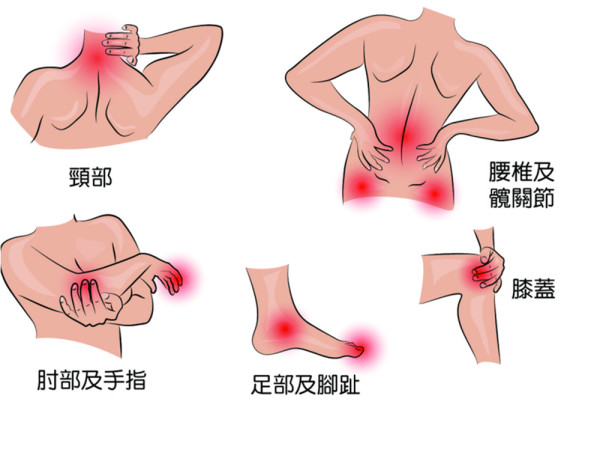 跑步時膝蓋痛?了解痛楚4大原因 1招助你天然止痛 全面回復關節健康