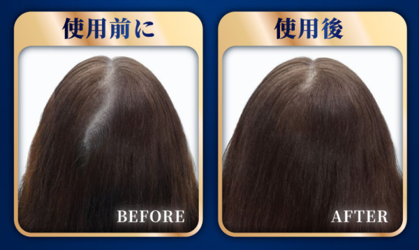 男性20歲開始脫髮? 1分鐘自我檢測:你的毛囊是否進入「休眠期」? 1招令頭髮大腦「毛乳頭」重生