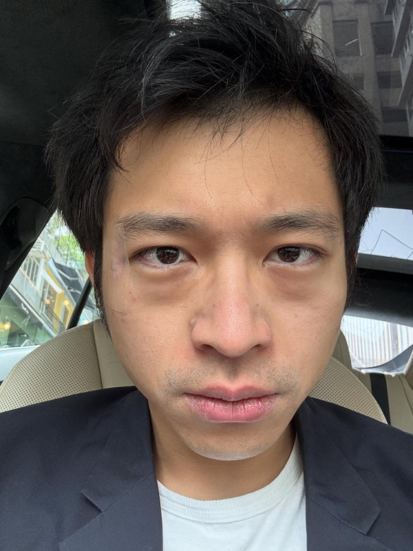 林作JPEX｜林作獲保釋後首度發文只擔心一件事 囂張本色不改：這就是我的實力